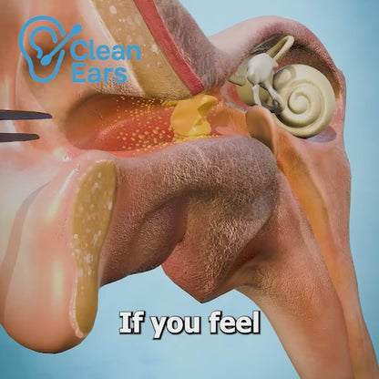 ClearEars Pro – Smart Ear Cleaner with HD Camera